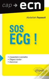 Sos Ecg !