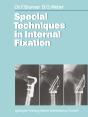 Special Techniques In Internal Fixation - Preview