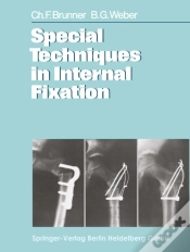 Capa do artigo Special Techniques In Internal Fixation