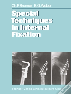 Capa do artigo Special Techniques In Internal Fixation