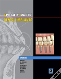 Capa do artigo Specialty Imaging: Dental Implants