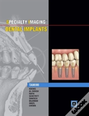 Capa do artigo Specialty Imaging: Dental Implants