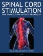 Spinal Cord Stimulation - Preview