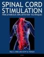 Spinal Cord Stimulation - Preview