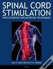 Capa do artigo Spinal Cord Stimulation