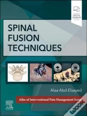 Capa do artigo Spinal Fusion Techniques - E-Book
