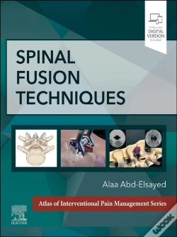 Capa do artigo Spinal Fusion Techniques - E-Book