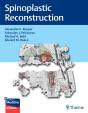 Spinoplastic Reconstruction - Preview