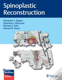 Capa do artigo Spinoplastic Reconstruction