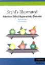Stahl'S Illustrated Attention Deficit Hyperactivity Disorder - Preview