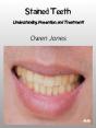 Stained Teeth - Preview