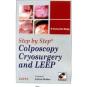 Step By Step Colposcopy Cryosur With Dv - Preview