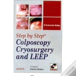 Capa do artigo Step By Step Colposcopy Cryosur With Dv