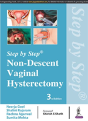 Step By Step: Non-Descent Vaginal Hysterectomy - Preview