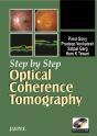 Step By Step Optical Coherence Tomography - Preview