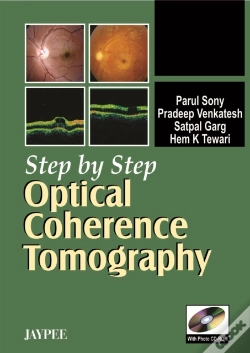 Capa do artigo Step By Step Optical Coherence Tomography