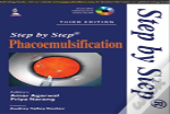 Step By Step Phacoemulsification