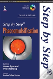 Capa do artigo Step By Step Phacoemulsification