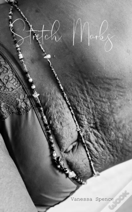 Stretch Marks