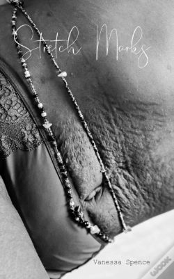 Capa do artigo Stretch Marks