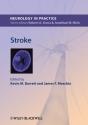 Stroke - Preview