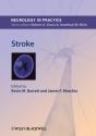 Stroke - Preview
