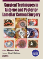 Surgery Technique In Anterior And Post. Lamellar Corneal Surgery - Preview