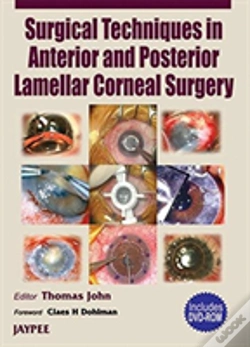Capa do artigo Surgery Technique In Anterior And Post. Lamellar Corneal Surgery