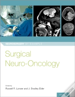 Capa do artigo Surgical Neuro-Oncology