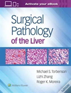 Capa do artigo Surgical Pathology Of The Liver