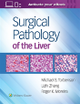 Surgical Pathology Of The Liver - Preview
