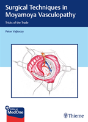 Surgical Techniques In Moyamoya Vasculopathy - Preview