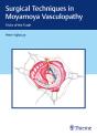 Surgical Techniques In Moyamoya Vasculopathy - Preview