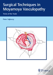 Capa do artigo Surgical Techniques In Moyamoya Vasculopathy