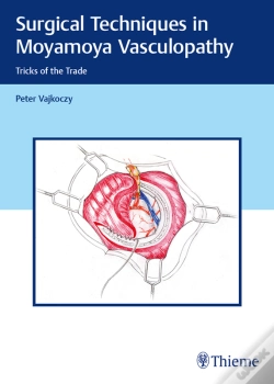 Capa do artigo Surgical Techniques In Moyamoya Vasculopathy
