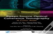 Swept-Source Optical Coherence Tomography: A Color Atlas