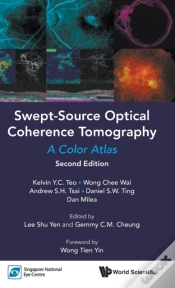 Capa do artigo Swept-Source Optical Coherence Tomography