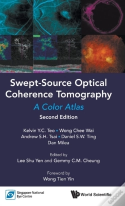 Capa do artigo Swept-Source Optical Coherence Tomography