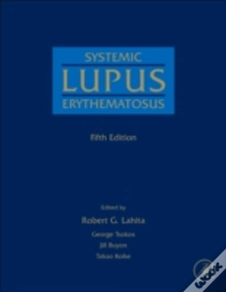 Capa do artigo Systemic Lupus Erythematosus