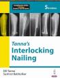 Tannaâ€™S Interlocking Nailing - Preview