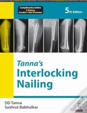 Capa do artigo Tannaâ€™S Interlocking Nailing
