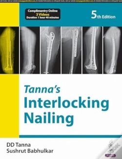 Capa do artigo Tannaâ€™S Interlocking Nailing
