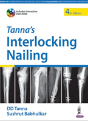 Tanna'S Interlocking Nailing - Preview