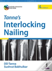 Tanna'S Interlocking Nailing