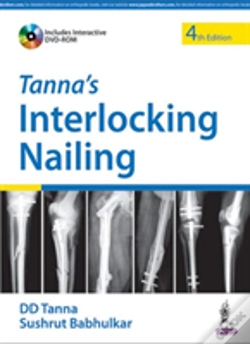 Capa do artigo Tanna'S Interlocking Nailing