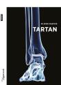 Tartan - Preview