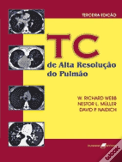 Capa do artigo TC de Alta Resolução do Pulmão