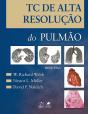 TC de Alta Resolução do Pulmão - Preview