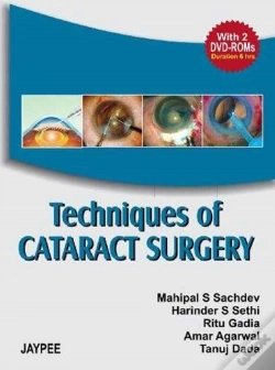 Capa do artigo Techniques Of Cataract Surgery