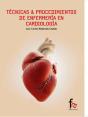 Tecnicas & Procedimientos De Enfermeria En Cardiologia - Preview